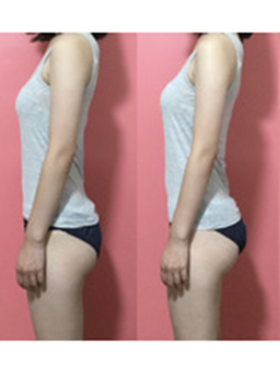 画像に alt 属性が指定されていません。ファイル名: image-7.png